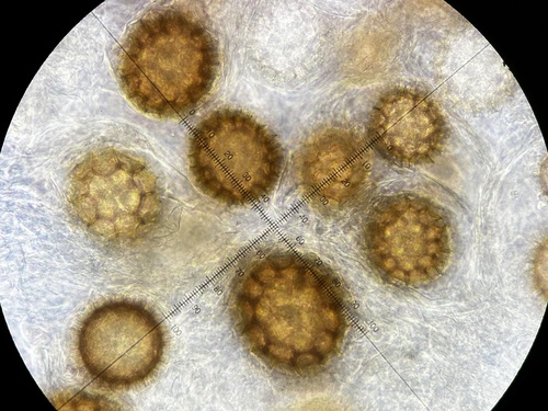 波氏块菌(Tuber borchii) 真实照片 · 拍摄者:peterkarasch